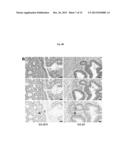 MODULATION OF HISTONE H2B MONOUBIQUITINATION AND TREATMENT OF CANCER diagram and image