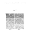 MODULATION OF HISTONE H2B MONOUBIQUITINATION AND TREATMENT OF CANCER diagram and image