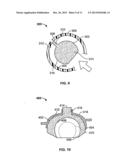 SPACER MOLD AND METHODS THEREFOR diagram and image