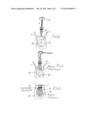 Process for securing a dental implant and dental implant diagram and image