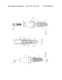 Process for securing a dental implant and dental implant diagram and image