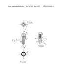 Process for securing a dental implant and dental implant diagram and image