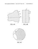 COATED ABRASIVE ARTICLE HAVING ROTATIONALLY ALIGNED FORMED CERAMIC     ABRASIVE PARTICLES AND METHOD OF MAKING diagram and image