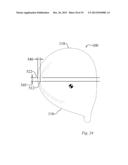 HIGH VOLUME AERODYNAMIC GOLF CLUB HEAD HAVING A POST APEX ATTACHMENT     PROMOTING REGION diagram and image