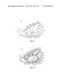 GOLF CLUB HAVING A REINFORCED BALL STRIKING PLATE diagram and image