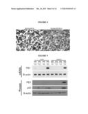 MODULATION OF p62 FUNCTION THROUGH THE PB1 DOMAIN diagram and image