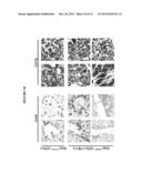 MODULATION OF p62 FUNCTION THROUGH THE PB1 DOMAIN diagram and image