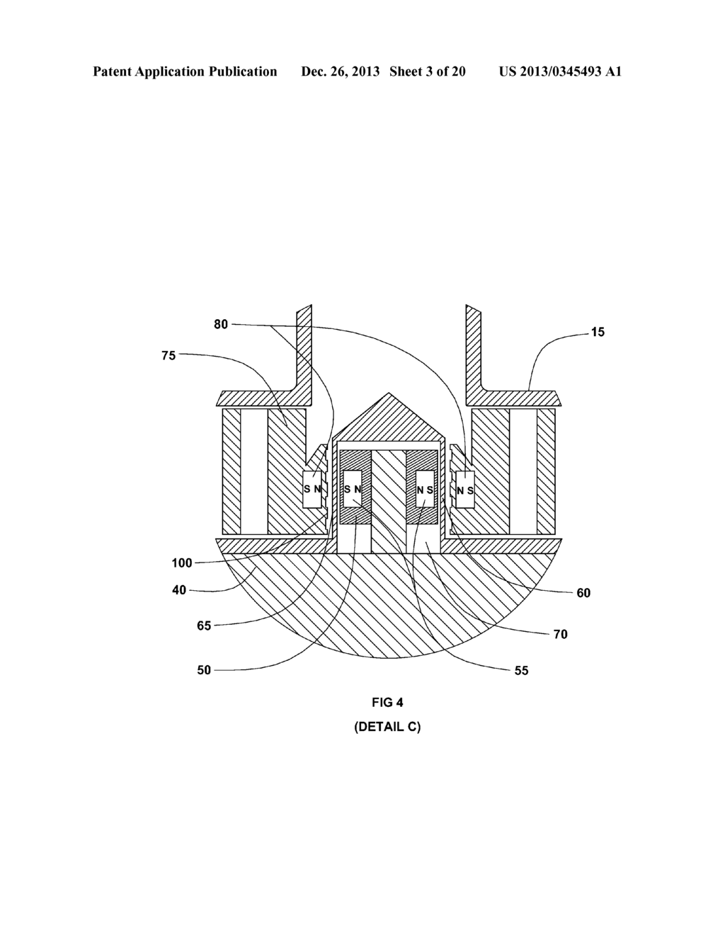 CARDIAC SUPPORT SYSTEMS AND METHODS FOR CHRONIC USE - diagram, schematic, and image 04