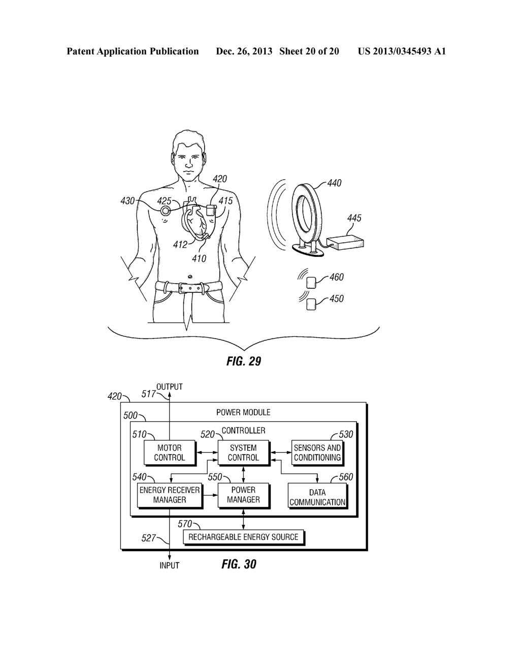 CARDIAC SUPPORT SYSTEMS AND METHODS FOR CHRONIC USE - diagram, schematic, and image 21