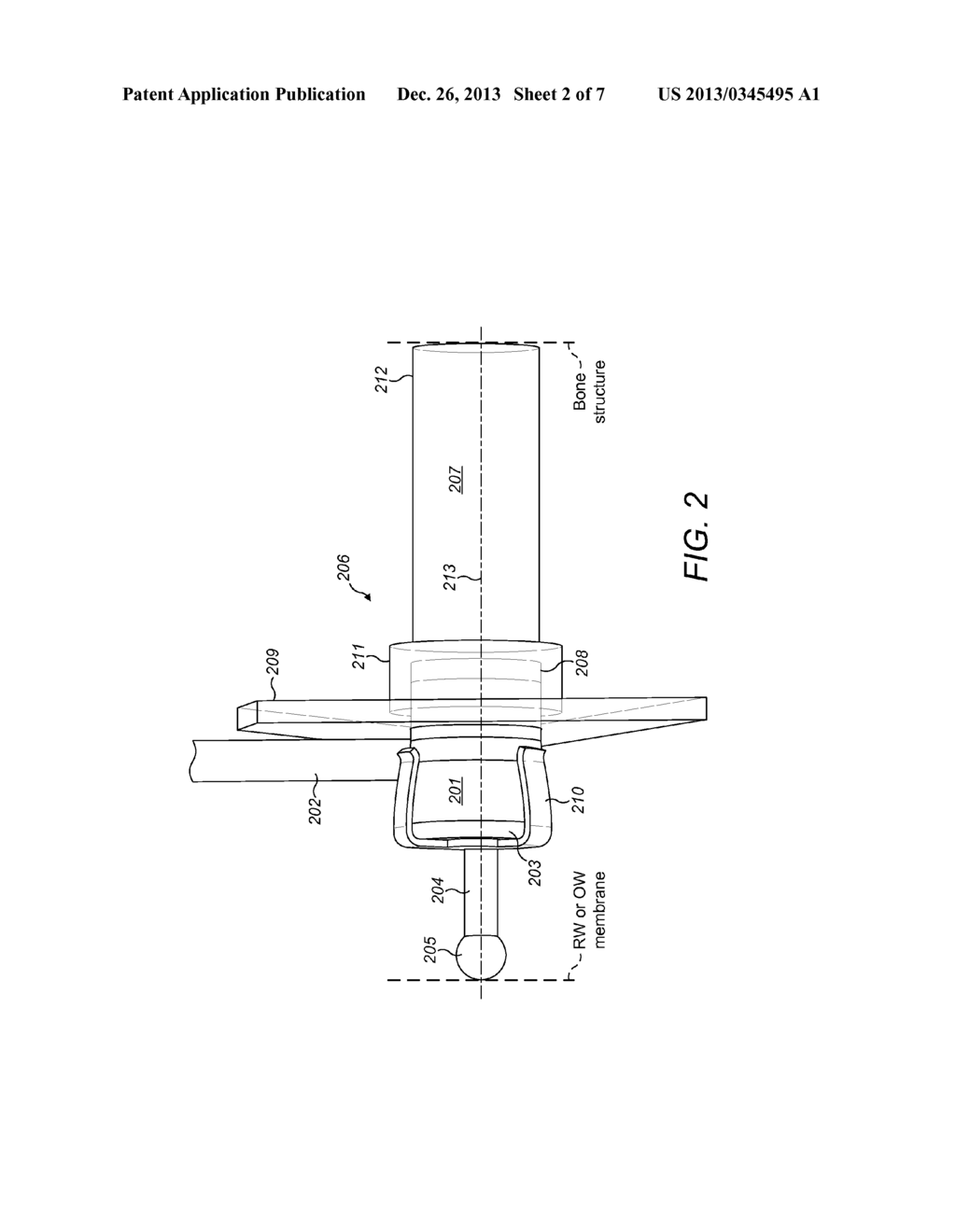 Optimal Pre-Load for Floating Mass Transducers - diagram, schematic, and image 03