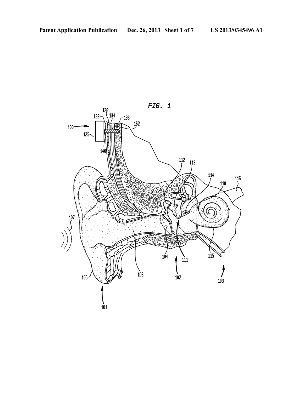 Bone Conduction Devices Generating Tangentially-Directed Mechanical Force     Using a Rotationally Moving Mass - diagram, schematic, and image 02