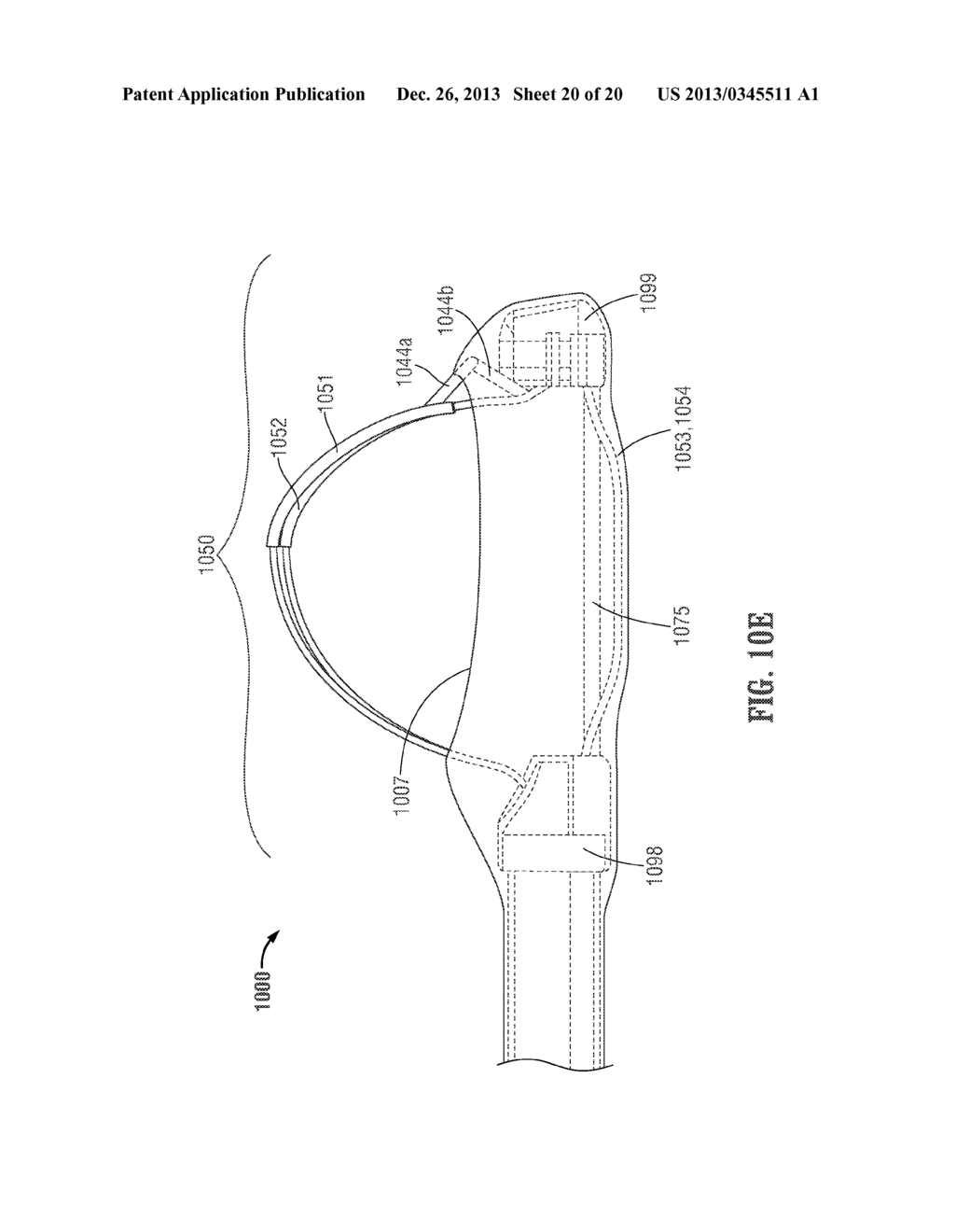 FLOATING, MULTI-LUMEN-CATHETER RETRACTOR SYSTEM FOR A MINIMALLY-INVASIVE,     OPERATIVE GASTROINTESTINAL TREATMENT - diagram, schematic, and image 21