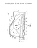 FLOATING, MULTI-LUMEN-CATHETER RETRACTOR SYSTEM FOR A MINIMALLY-INVASIVE,     OPERATIVE GASTROINTESTINAL TREATMENT diagram and image