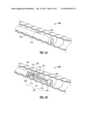 FLOATING, MULTI-LUMEN-CATHETER RETRACTOR SYSTEM FOR A MINIMALLY-INVASIVE,     OPERATIVE GASTROINTESTINAL TREATMENT diagram and image