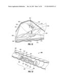 FLOATING, MULTI-LUMEN-CATHETER RETRACTOR SYSTEM FOR A MINIMALLY-INVASIVE,     OPERATIVE GASTROINTESTINAL TREATMENT diagram and image