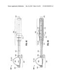 FLOATING, MULTI-LUMEN-CATHETER RETRACTOR SYSTEM FOR A MINIMALLY-INVASIVE,     OPERATIVE GASTROINTESTINAL TREATMENT diagram and image