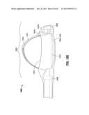 FLOATING, MULTI-LUMEN-CATHETER RETRACTOR SYSTEM FOR A MINIMALLY-INVASIVE,     OPERATIVE GASTROINTESTINAL TREATMENT diagram and image