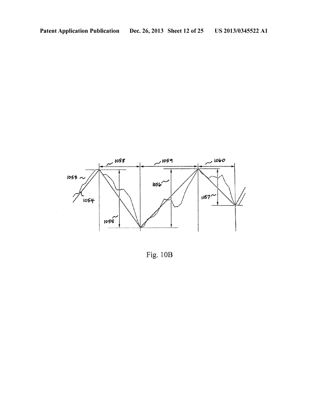 DEVICES AND METHODS FOR MONITORING PHYSIOLOGICAL INFORMATION RELATING TO     SLEEP WITH AN IMPLANTABLE DEVICE - diagram, schematic, and image 13