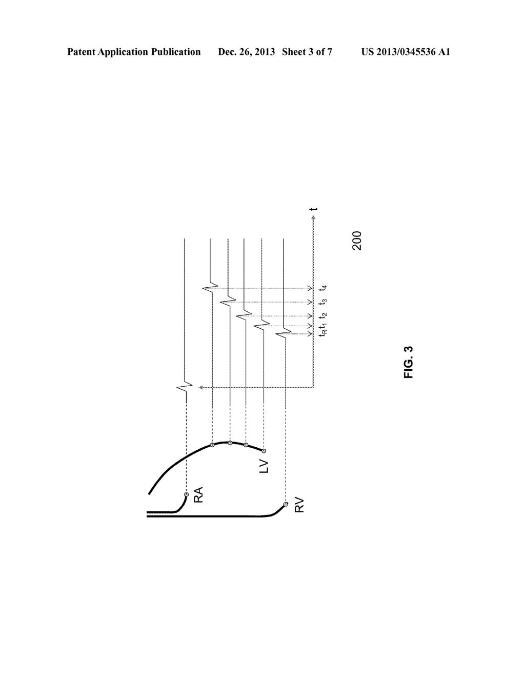 DISLOCATION SENSOR - diagram, schematic, and image 04