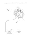 FAR-FIELD VS LOCAL ACTIVATION DISCRIMINATION ON MULTI-ELECTRODE EGMS USING     VECTOR ANALYSIS IN MULTI-DIMENSIONAL SIGNAL SPACE diagram and image