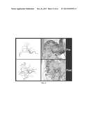 QUANTITATIVE PERFUSION ANALYSIS FOR EMBOLOTHERAPY diagram and image