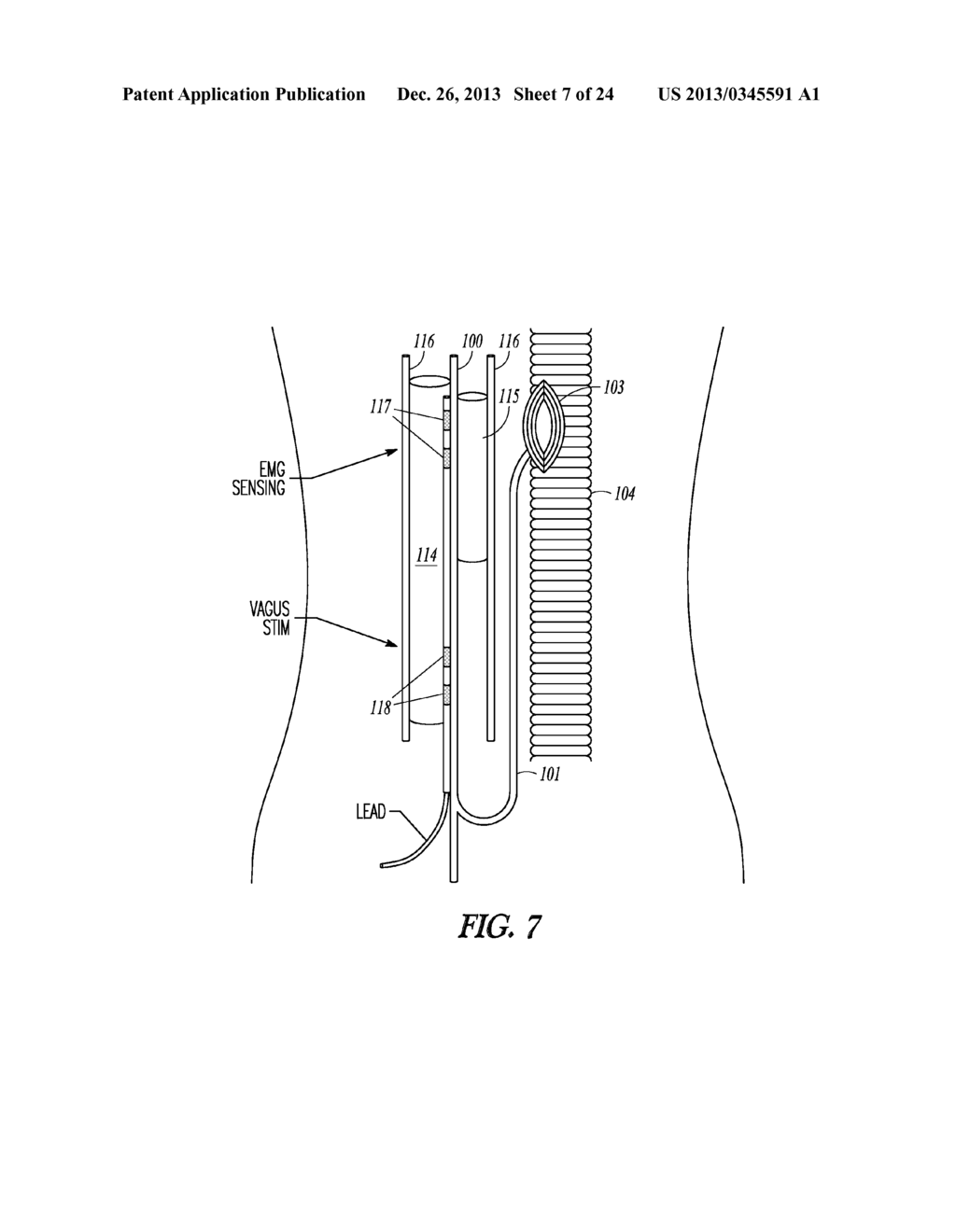 METHOD FOR DETECTING VAGUS CAPTURE - diagram, schematic, and image 08