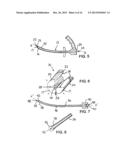 BONE TAMP APPARATUS AND METHOD diagram and image