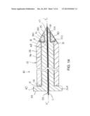 BONE TAMP APPARATUS AND METHOD diagram and image