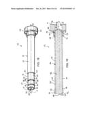 BONE TAMP APPARATUS AND METHOD diagram and image