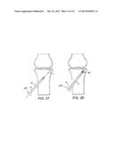 BONE TAMP APPARATUS AND METHOD diagram and image