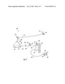 HIGH FLOW RATE ISOLATED INFUSION FOR REGIONAL TREATMENT OF CANCER AND     MEDICAL CONDITIONS diagram and image