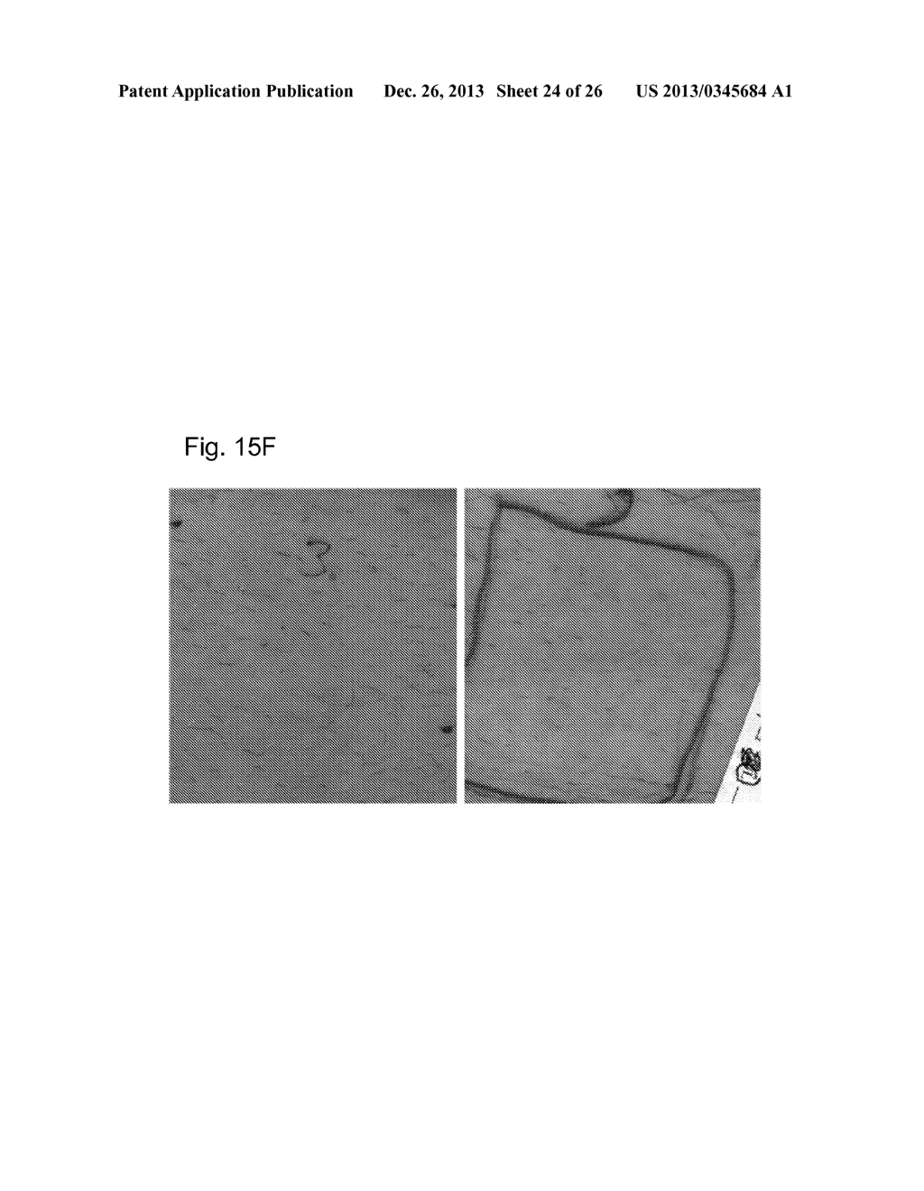 Hair Removal Devices and Methods - diagram, schematic, and image 25