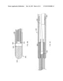 CRYOABLATION BALLOON CATHETER AND RELATED METHOD diagram and image