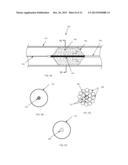 CRYOABLATION BALLOON CATHETER AND RELATED METHOD diagram and image