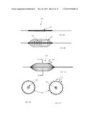 CRYOABLATION BALLOON CATHETER AND RELATED METHOD diagram and image