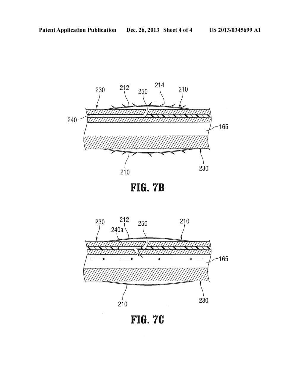 ABLATION DEVICE HAVING AN EXPANDABLE CHAMBER FOR ANCHORING THE ABLATION     DEVICE TO TISSUE - diagram, schematic, and image 05