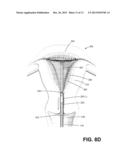 ENDOMETRIAL ABLATION METHOD diagram and image