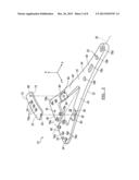 Orthopedic Plate Assembly for a Distal Radius Having Re-Contouring     Features and Method for Using Same diagram and image