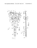 Orthopedic Plate Assembly for a Distal Radius Having Re-Contouring     Features and Method for Using Same diagram and image