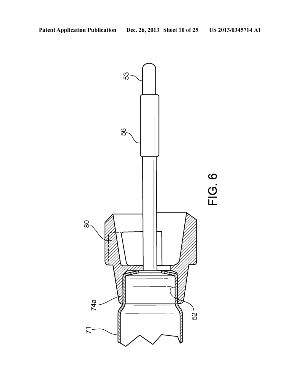 Uterine Manipulator Assemblies and Related Components and Methods - diagram, schematic, and image 11