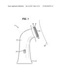 MECHANICAL SKIN RESURFACING diagram and image