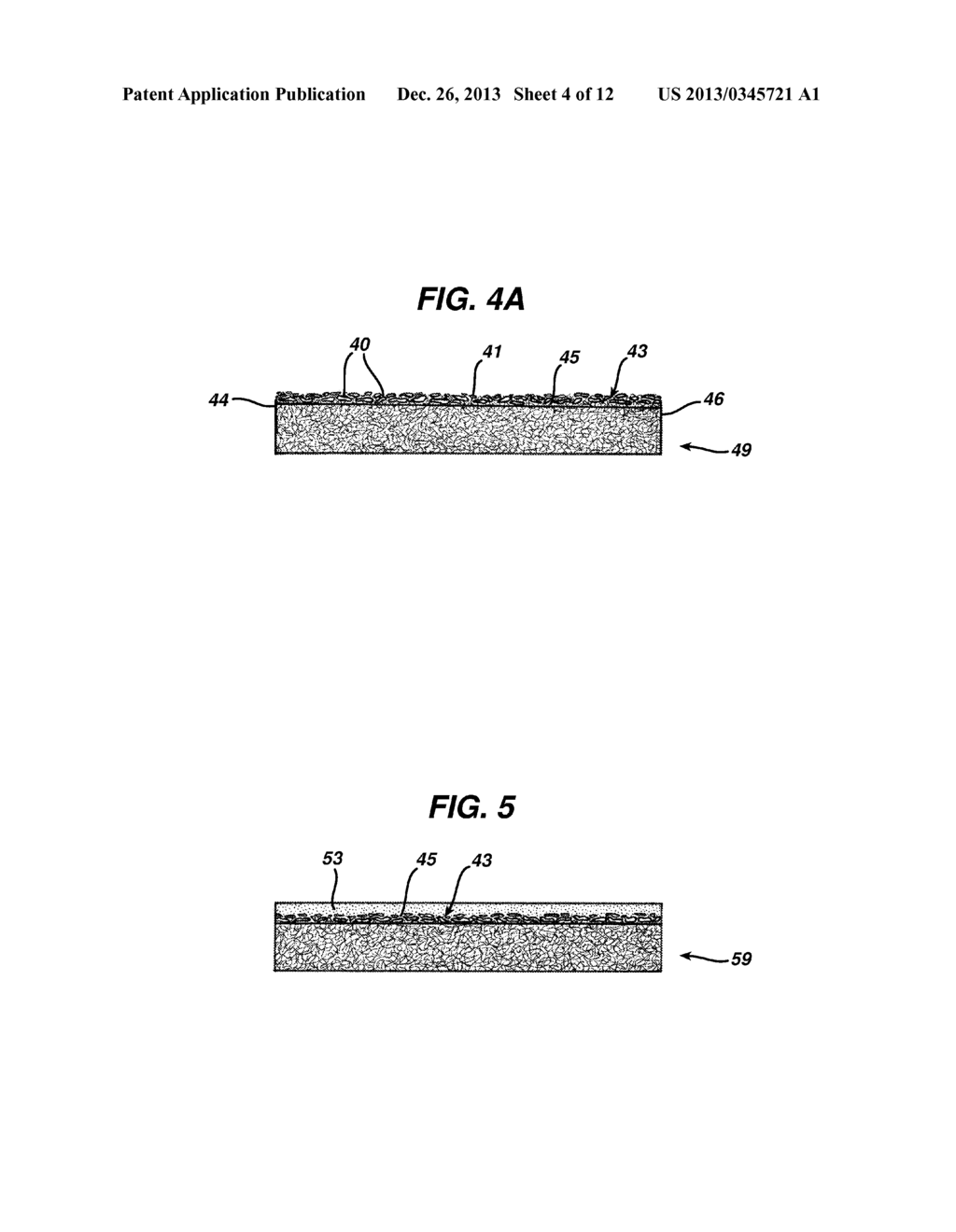 MECHANICAL SKIN RESURFACING - diagram, schematic, and image 05