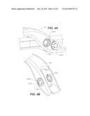 ULTRASONIC DEVICE FOR CUTTING AND COAGULATING diagram and image