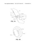 ULTRASONIC DEVICE FOR CUTTING AND COAGULATING diagram and image