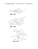 ULTRASONIC DEVICE FOR CUTTING AND COAGULATING diagram and image