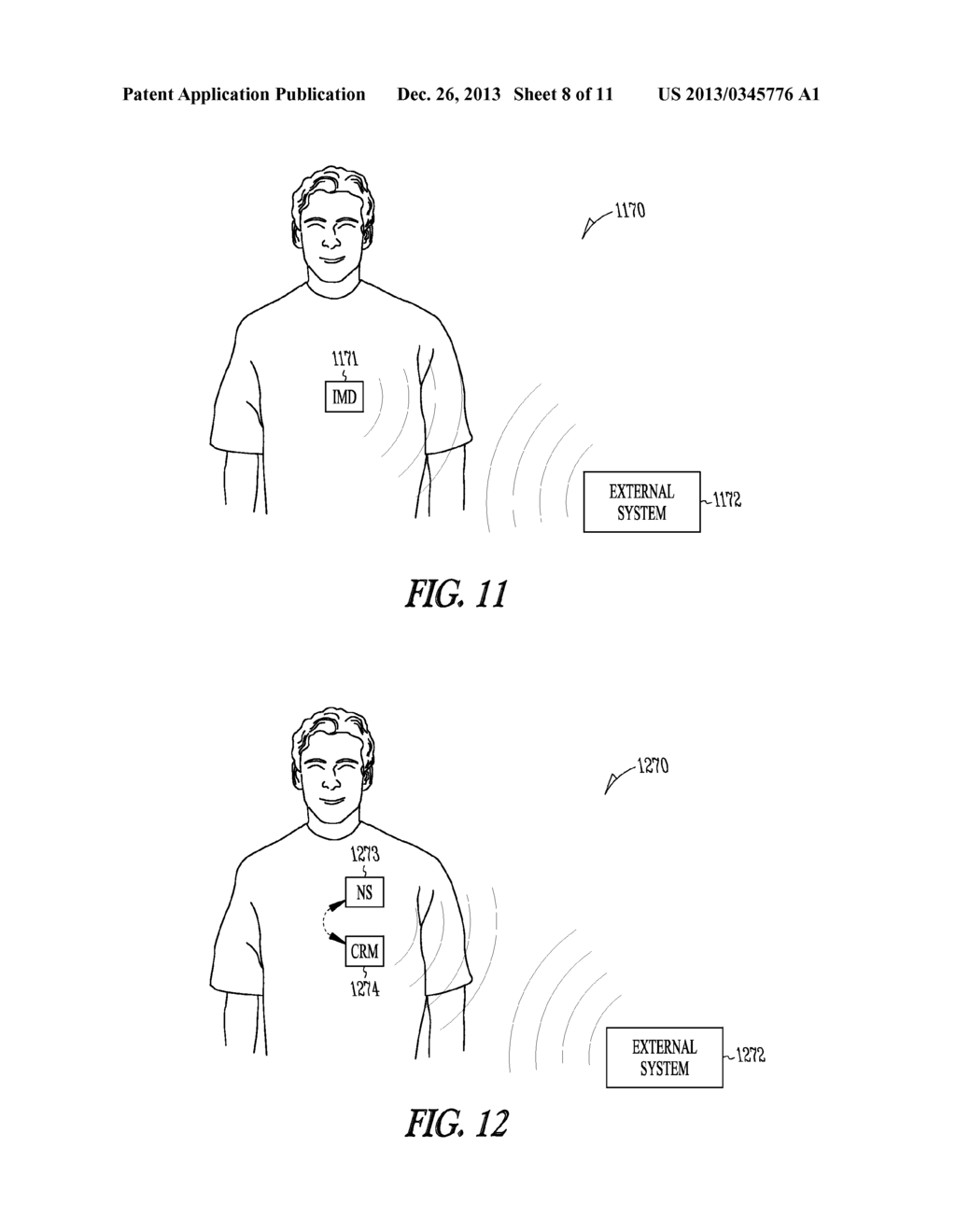 SYSTEM FOR ABATING NEURAL STIMULATION SIDE EFFECTS - diagram, schematic, and image 09