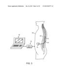 NEUROSTIMULATION SYSTEM FOR ENABLING MAGNETIC FIELD SENSING WITH A     SHUT-DOWN HALL SENSOR diagram and image