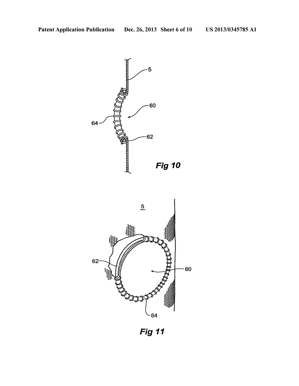 FENESTRATED STENT GRAFTS - diagram, schematic, and image 07