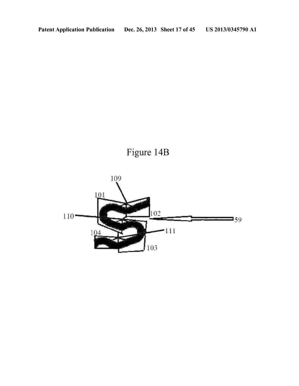 MEDICAL DEVICE FOR IMPLANTATION INTO LUMINAL STRUCTURES - diagram, schematic, and image 18