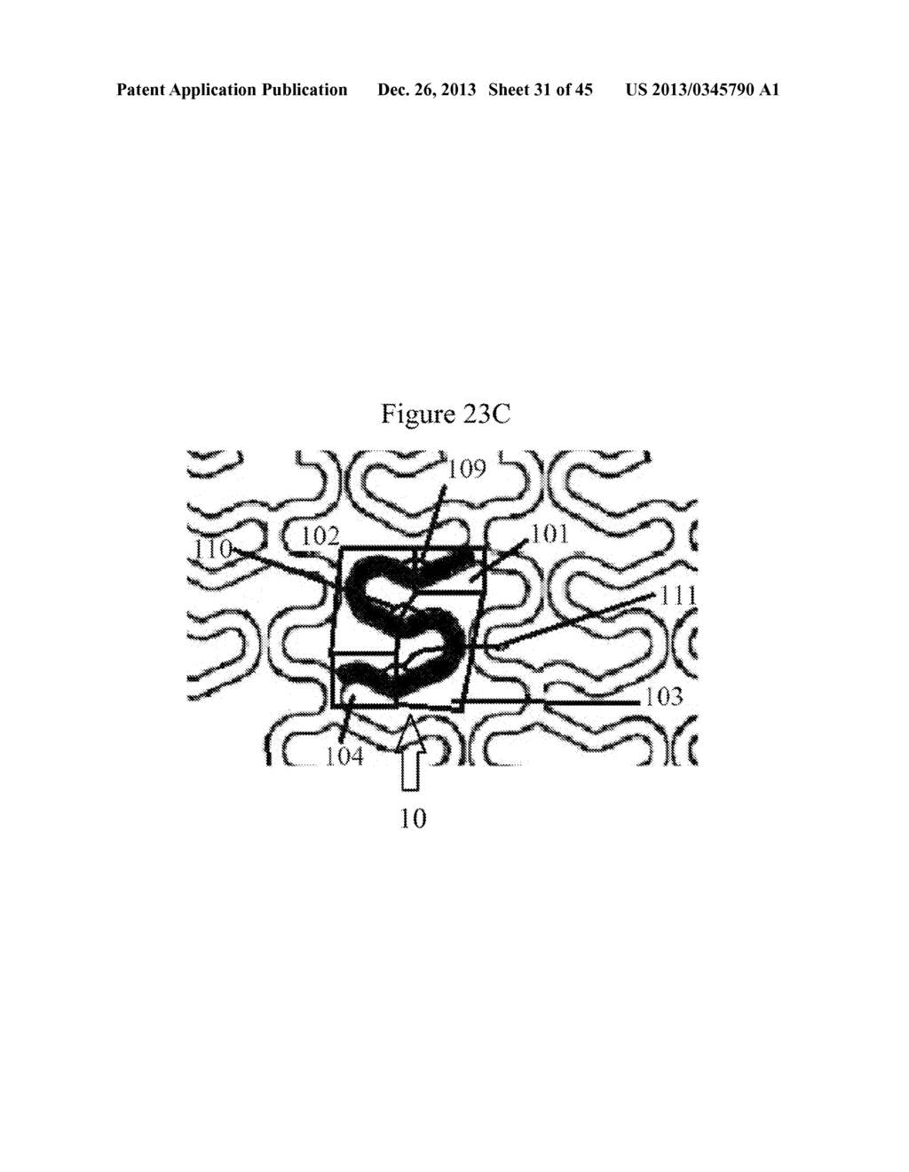 MEDICAL DEVICE FOR IMPLANTATION INTO LUMINAL STRUCTURES - diagram, schematic, and image 32